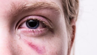 násilí trauma-3485235 1280
